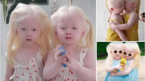 Mesmerizing Beauty: Twin Babies Born with Snow-White Hair Captivate Everyone Who Sees Them