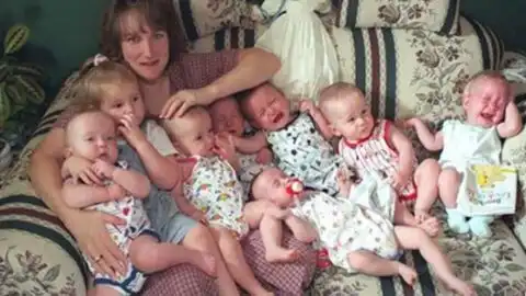 25-Year-Old Iraqi Woman’s Natural Delivery of Seven Babies