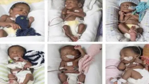 Houston Woman Delivers Sextuplets in Just Nine Minutes, Defying 1 in 4.7 Billion Odds