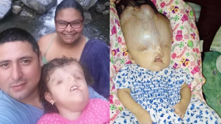 Born to Be Loved: A Mother’s Fight to Give Her Daughter with Severe Birth Defects a Chance at Life