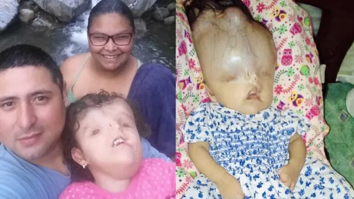 Born to Be Loved: A Mother’s Fight to Give Her Daughter with Severe Birth Defects a Chance at Life
