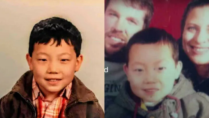 Abandoned Burned at 1 on a Doorstep, Burn Survivor’s Journey from Foster Care to Family