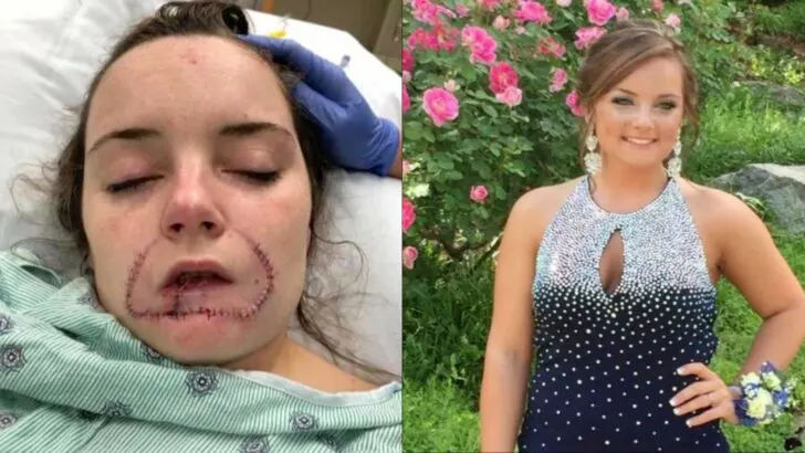 He claimed he was going to leave his mark on me. I had a scar wrapping from cheek to cheek, now known as the ‘girl that had her lip bitten off.’