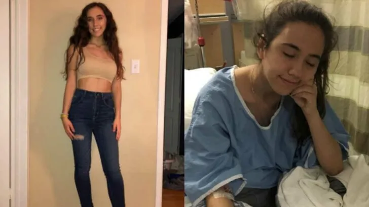 People Think My Ostomy Bag Is Gross but It Saved My Life