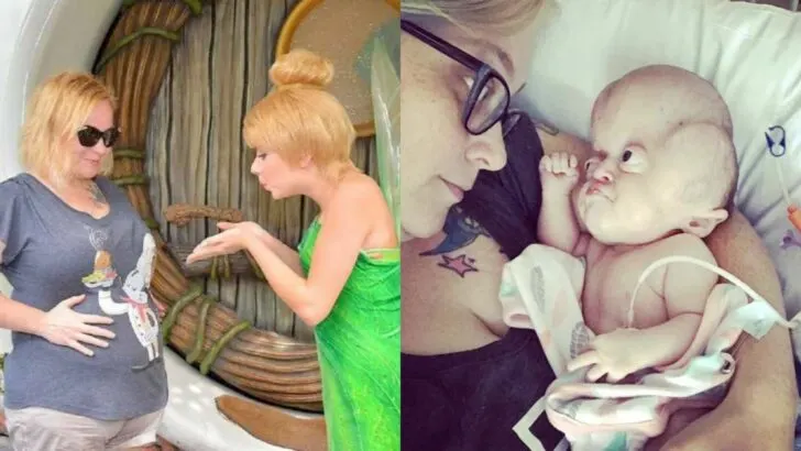 Her Eyes Were Huge, Her Skull Misshapen. We Braced Ourselves, But Seeing Emmy in Person Was Still a Shock