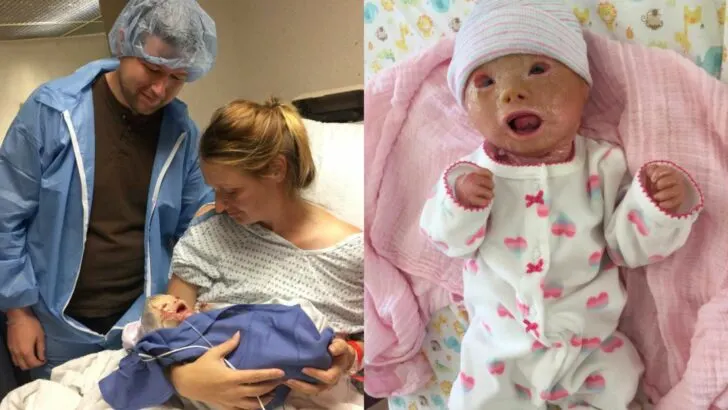 My Daughter Was Born With Extremely Thick Skin. Her Journey With Harlequin Ichthyosis Has Redefined Strength