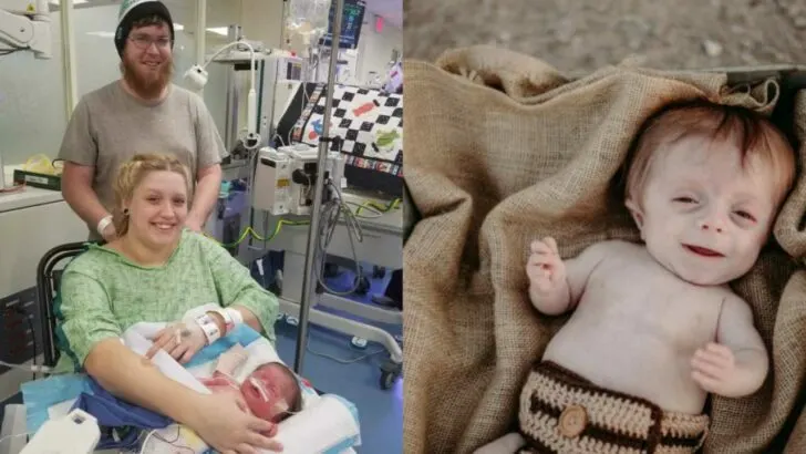 Told He Wouldn’t Survive, Our Baby with Brittle Bone Disease Defied Every Odd