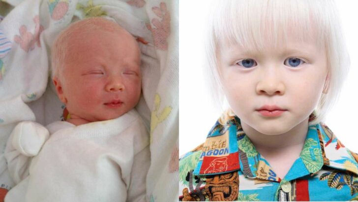 ‘Whoa! He Has Some Really Blonde Hair.’ I Just Knew My Husband Smiled, ‘He’s an Albino,’ Says Mother