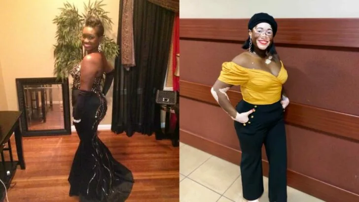 The day I found out my husband had another child my daughters age a woman’s incredible journey with vitiligo