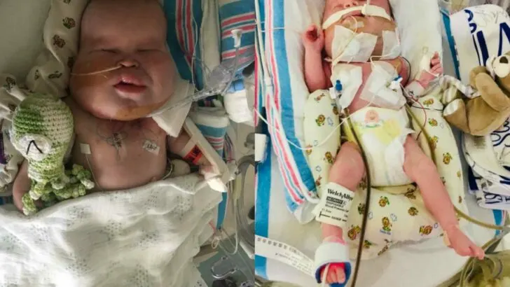 Mom’s Fairytale Pregnancy Shattered by Rare Diagnosis, Ends in Bliss