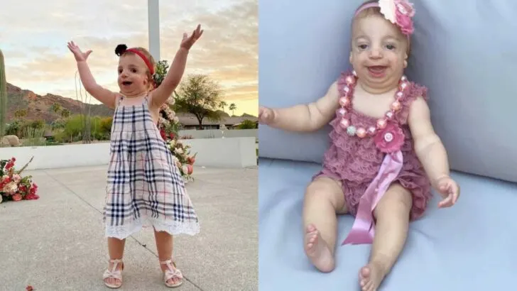 Our daughter Bella was born with Treacher Collins syndrome, teaching us strength, love, and hope beyond expectations