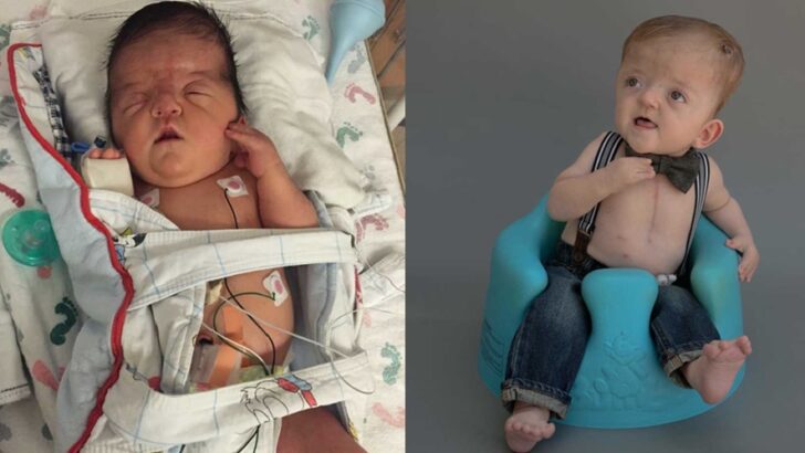 “I Coded, He Wasn’t Breathing”: A Mom’s Life-or-Death Delivery and Her Son’s Rare Apert Syndrome Journey