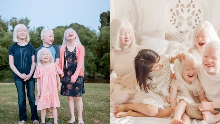 Adopting Hope: How One Family Embraced the Journey of Raising Four Children with Albinism, and Found Unexpected Joy in a Rare Life