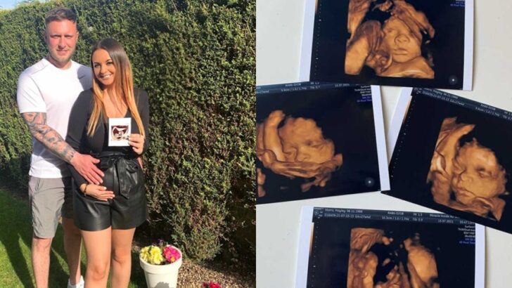 A Mother’s Journey Through Stillbirth at 40 Weeks: Facing Placenta Abruption, Grief, and Turning Her Son Ollie’s Memory Into Hope