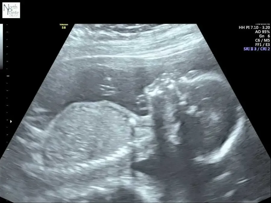 This image has an empty alt attribute; its file name is image-1342.png