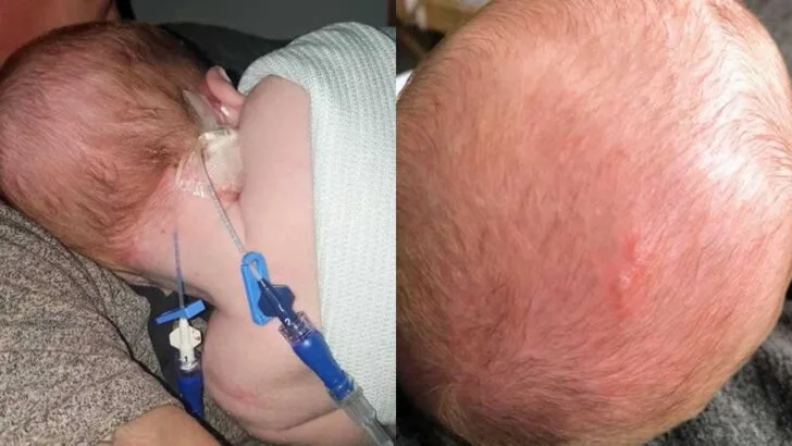 From a Tiny Blister to a Life-Threatening Diagnosis: A Mother’s Warning After Her Newborn’s Battle with Herpes Misdiagnosed as Eczema