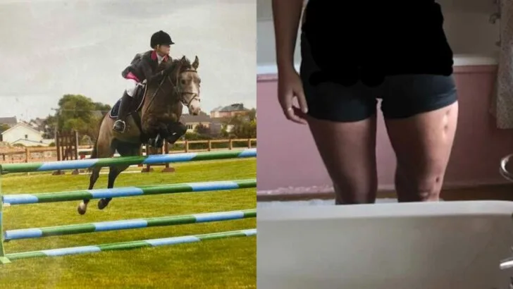 My femur snapped in the kitchen and it was the best day of my life surviving