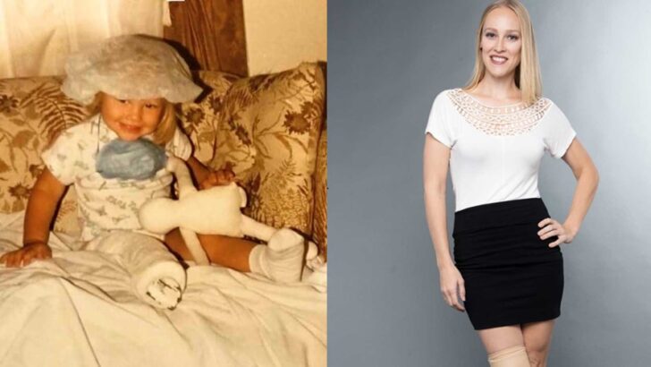 More Than a Missing Leg: How an Amputee Athlete and Advocate Redefined Beauty, Strength, and Wholeness by Turning Her Difference into Her Greatest Power